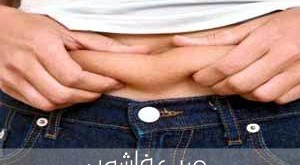 لعلاج الترهلات في الجسم